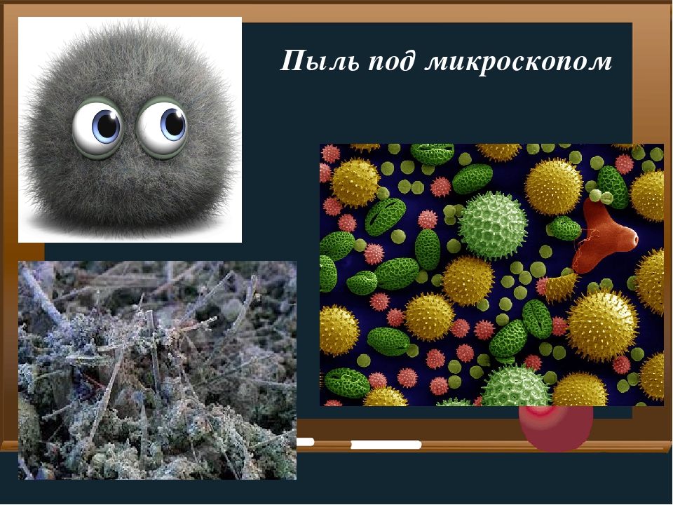 Пыль это. Пыль под микроскопом. Пылинка под микроскопом. Домашняя пыль под микроскопом. Пыль в микроскопе.